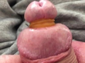 Tied glands.