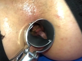 Speculum